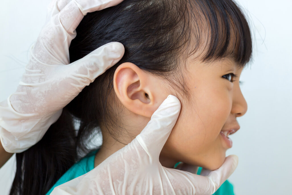 Dealing with Child’s Earwax